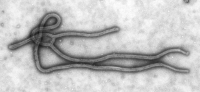 Transmission electron micrograph of the Ebola virus.
